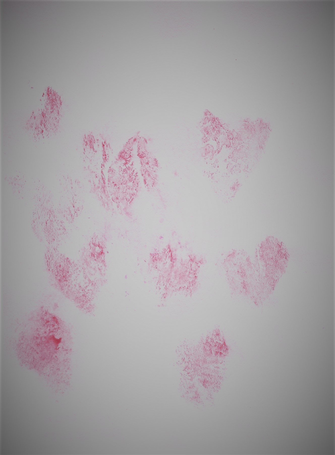 print of hearts painted on and around labia
