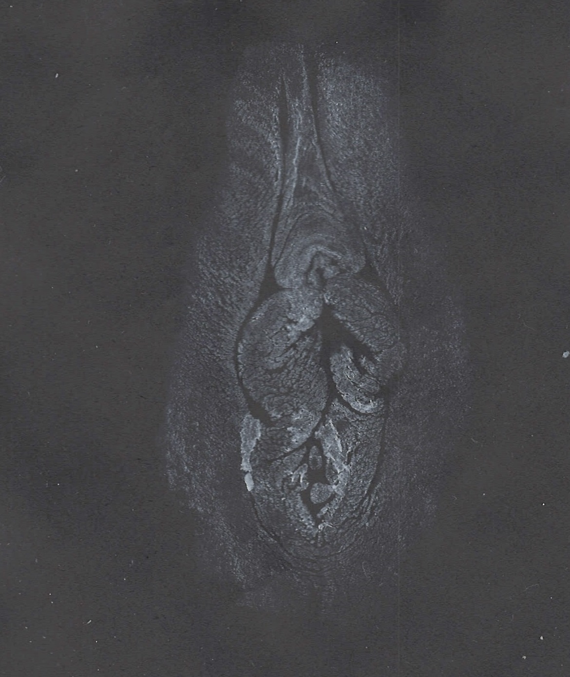 white print of vulva on black paper
